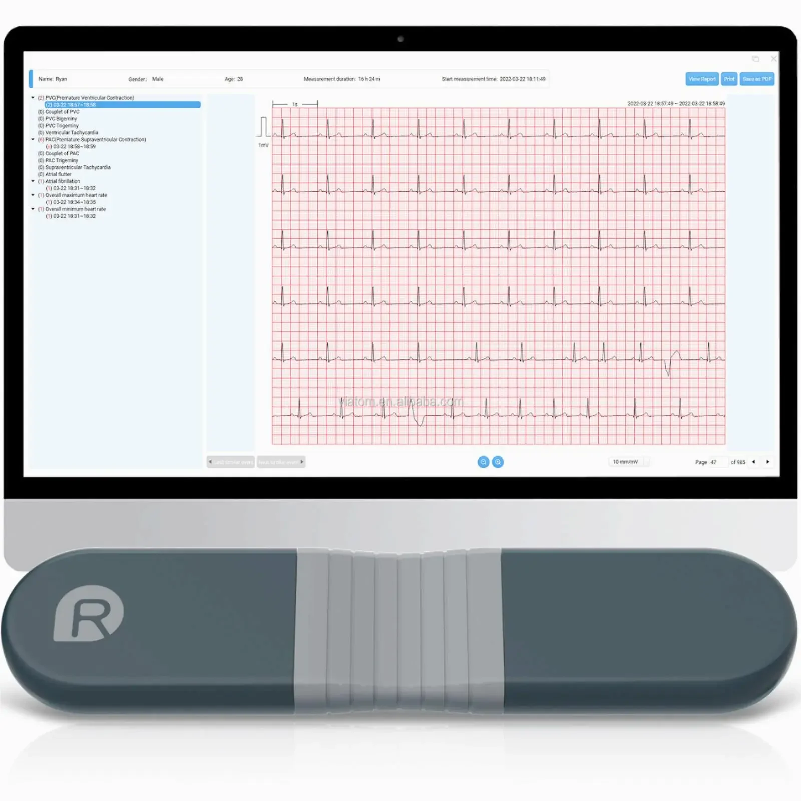 Wireless Bluetooth Dynamic Rec - Ecg Patch Monitor review and price